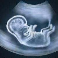 W którym dniu USG pokazuje ciążę?